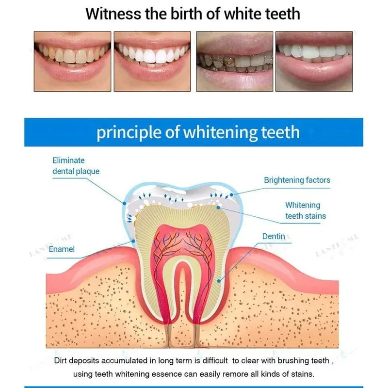 Dentipen™️ - Pack of 2