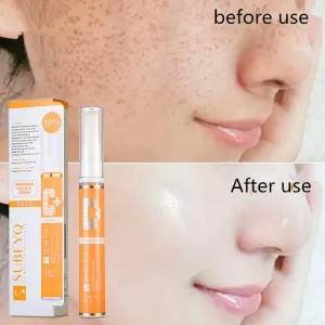 Whitening Freckle cream